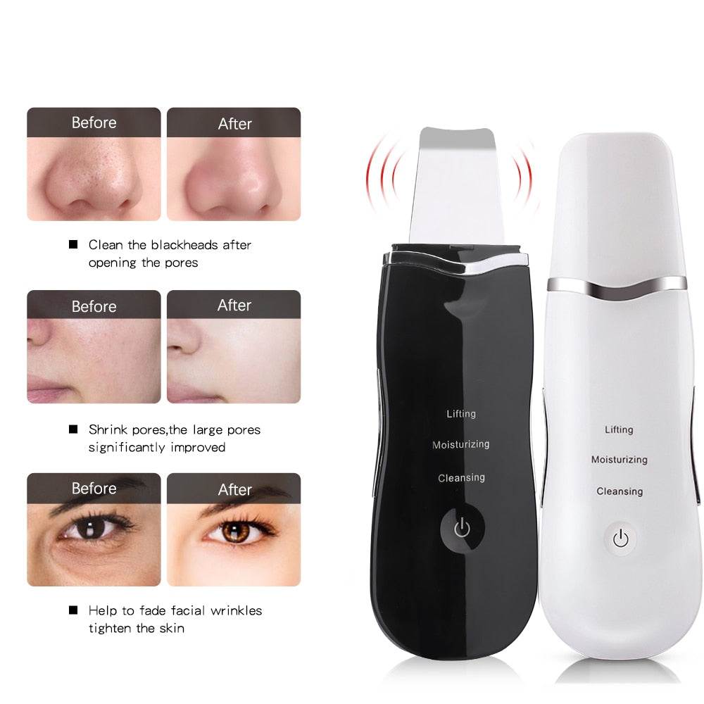 Ultrasonic Facial Scrubber