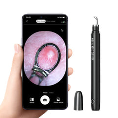 Visible Blackhead Remover
